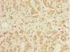 Immunohistochemistry of paraffin-embedded human adrenal gland tissue using CSB-PA861986DSR1HU at dilution of 1:100