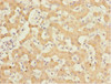 Immunohistochemistry of paraffin-embedded human liver tissue using CSB-PA861986DSR2HU at dilution of 1:100