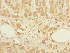 Immunohistochemistry of paraffin-embedded human adrenal gland tissue using CSB-PA861986DSR2HU at dilution of 1:100