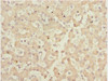 Immunohistochemistry of paraffin-embedded human liver tissue using CSB-PA822304ESR1HU at dilution of 1:100