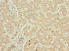 Immunohistochemistry of paraffin-embedded human liver tissue using CSB-PA822304ESR2HU at dilution of 1:100