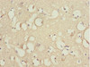 Immunohistochemistry of paraffin-embedded human brain tissue using CSB-PA823893ESR1HU at dilution of 1:100