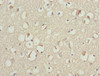 Immunohistochemistry of paraffin-embedded human brain tissue using CSB-PA823893ESR2HU at dilution of 1:100