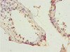 Immunohistochemistry of paraffin-embedded human testis tissue using CSB-PA012487ESR1HU at dilution of 1:100