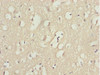 Immunohistochemistry of paraffin-embedded human brain tissue using CSB-PA012487ESR2HU at dilution of 1:100