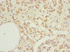 Immunohistochemistry of paraffin-embedded human adrenal gland tissue using CSB-PA012488ESR1HU at dilution of 1:100