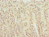 Immunohistochemistry of paraffin-embedded human adrenal gland tissue using CSB-PA012488ESR2HU at dilution of 1:100