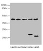 Western blot<br />
 All lanes: LHX6 antibody at 3.02µg/ml<br />
 Lane 1: HepG2 whole cell lysate<br />
 Lane 2: U87 whole cell lysate<br />
 Lane 3: NIH/3T3 whole cell lysate<br />
 Lane 4: Mouse brain tissue<br />
 Lane 5: Mouse liver tissue<br />
 Secondary<br />
 Goat polyclonal to rabbit IgG at 1/10000 dilution<br />
 Predicted band size: 41, 39, 44, 42, 20 kDa<br />
 Observed band size: 41, 22, 20 kDa<br />