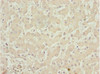 Immunohistochemistry of paraffin-embedded human liver tissue using CSB-PA891795ESR1HU at dilution of 1:100