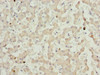 Immunohistochemistry of paraffin-embedded human liver tissue using CSB-PA891795ESR2HU at dilution of 1:100
