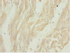 Immunohistochemistry of paraffin-embedded human heart tissue using CSB-PA836674ESR1HU at dilution of 1:100