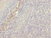 Immunohistochemistry of paraffin-embedded human tonsil tissue using CSB-PA013695ESR2HU at dilution of 1:100