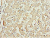 Immunohistochemistry of paraffin-embedded human liver tissue using CSB-PA014707ESR1HU at dilution of 1:100