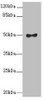 Western blot<br />
 All lanes: MOCS3 antibody at 2.1µg/ml + A549 whole cell lysate<br />
 Secondary<br />
 Goat polyclonal to rabbit IgG at 1/10000 dilution<br />
 Predicted band size: 50 kDa<br />
 Observed band size: 50 kDa<br />