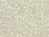 Immunohistochemistry of paraffin-embedded human liver tissue using CSB-PA014707ESR2HU at dilution of 1:100