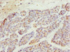 Immunohistochemistry of paraffin-embedded human pancreatic tissue using CSB-PA873627ESR1HU at dilution of 1:100