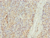 Immunohistochemistry of paraffin-embedded human pancreatic tissue using CSB-PA873627ESR2HU at dilution of 1:100