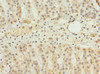 Immunohistochemistry of paraffin-embedded human adrenal gland tissue using CSB-PA622775ESR2HU at dilution of 1:100