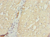 Immunohistochemistry of paraffin-embedded human small intestine tissue using CSB-PA889125ESR1HU at dilution of 1:100