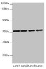Western blot<br />
 All lanes: OSGEP antibody at 3.18µg/ml<br />
 Lane 1: 293T whole cell lysate<br />
 Lane 2: Jurkat whole cell lysate<br />
 Lane 3: Raji whole cell lysate<br />
 Lane 4: PC-3 whole cell lysate<br />
 Secondary<br />
 Goat polyclonal to rabbit IgG at 1/10000 dilution<br />
 Predicted band size: 36 kDa<br />
 Observed band size: 36 kDa<br />