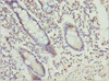 Immunohistochemistry of paraffin-embedded human small intestine tissue using CSB-PA878842ESR1HU at dilution of 1:100