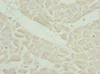 Immunohistochemistry of paraffin-embedded human heart tissue using CSB-PA878842ESR2HU at dilution of 1:100