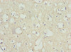 Immunohistochemistry of paraffin-embedded human brain tissue using CSB-PA017800ESR1HU at dilution of 1:100