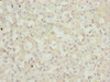 Immunohistochemistry of paraffin-embedded human liver tissue using CSB-PA017804ESR1HU at dilution of 1:100