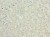 Immunohistochemistry of paraffin-embedded human liver tissue using CSB-PA017804ESR2HU at dilution of 1:100