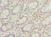 Immunohistochemistry of paraffin-embedded human colon tissue using CSB-PA017804ESR2HU at dilution of 1:100