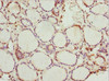 Immunohistochemistry of paraffin-embedded human thyroid tissue using CSB-PA018774ESR2HU at dilution of 1:100