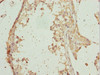 Immunohistochemistry of paraffin-embedded human testis tissue using CSB-PA614438ESR1HU at dilution of 1:100