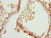 Immunohistochemistry of paraffin-embedded human testis tissue using CSB-PA614438ESR2HU at dilution of 1:100