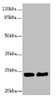 Western blot<br />
 All lanes: RAB5B antibody at 5.16µg/ml<br />
 Lane 1: Hela whole cell lysate<br />
 Lane 2: Jurkat whole cell lysate<br />
 Secondary<br />
 Goat polyclonal to rabbit IgG at 1/10000 dilution<br />
 Predicted band size: 24, 20 kDa<br />
 Observed band size: 24 kDa<br />