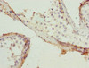 Immunohistochemistry of paraffin-embedded human testis tissue using CSB-PA019214ESR2HU at dilution of 1:100