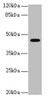 Western blot<br />
 All lanes: RFPL2 antibody at 3.36µg/ml + MCF-7 whole cell lysate<br />
 Secondary<br />
 Goat polyclonal to rabbit IgG at 1/10000 dilution<br />
 Predicted band size: 43, 33, 36 kDa<br />
 Observed band size: 43 kDa<br />