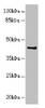 Western blot<br />
 All lanes: RFPL2 antibody at 3.41µg/ml + MCF-7 whole cell lysate<br />
 Secondary<br />
 Goat polyclonal to rabbit IgG at 1/10000 dilution<br />
 Predicted band size: 43, 33, 36 kDa<br />
 Observed band size: 43 kDa<br />