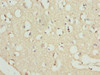 Immunohistochemistry of paraffin-embedded human brain tissue using CSB-PA019599ESR2HU at dilution of 1:100