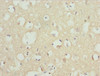 Immunohistochemistry of paraffin-embedded human brain tissue using CSB-PA896492ESR1HU at dilution of 1:100