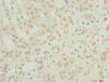 Immunohistochemistry of paraffin-embedded human adrenal gland tissue using CSB-PA896492ESR2HU at dilution of 1:100