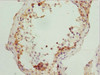 Immunohistochemistry of paraffin-embedded human testis tissue using CSB-PA848835ESR2HU at dilution of 1:100