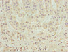 Immunohistochemistry of paraffin-embedded human adrenal gland tissue using CSB-PA848835ESR2HU at dilution of 1:100