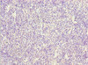 Immunohistochemistry of paraffin-embedded human thymus tissue using CSB-PA897531ESR2HU at dilution of 1:100