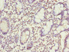 Immunohistochemistry of paraffin-embedded human small intestine tissue using CSB-PA891565ESR1HU at dilution of 1:100