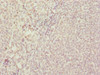 Immunohistochemistry of paraffin-embedded human tonsil tissue using CSB-PA022957ESR1HU at dilution of 1:100