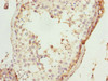 Immunohistochemistry of paraffin-embedded human testis tissue using CSB-PA624027DSR1HU at dilution of 1:100