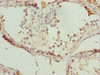 Immunohistochemistry of paraffin-embedded human testis tissue using CSB-PA023240ESR1HU at dilution of 1:100