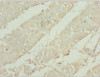 Immunohistochemistry of paraffin-embedded human heart tissue using CSB-PA023240ESR2HU at dilution of 1:100