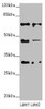 Western blot<br />
 All lanes: ZNF785 antibody at 6.27µg/ml<br />
 Lane 1: Hela whole cell lysate<br />
 Lane 2: PC-3 whole cell lysate<br />
 Secondary<br />
 Goat polyclonal to rabbit IgG at 1/10000 dilution<br />
 Predicted band size: 47, 45 kDa<br />
 Observed band size: 47, 65, 30 kDa<br />