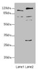 Western blot<br />
 All lanes: TM9SF1 antibody at 2.18µg/ml<br />
 Lane 1: Mouse liver tissue<br />
 Lane 2: Mouse kidney tissue<br />
 Secondary<br />
 Goat polyclonal to rabbit IgG at 1/10000 dilution<br />
 Predicted band size: 69, 56 kDa<br />
 Observed band size: 69, 110, 59, 28 kDa<br />